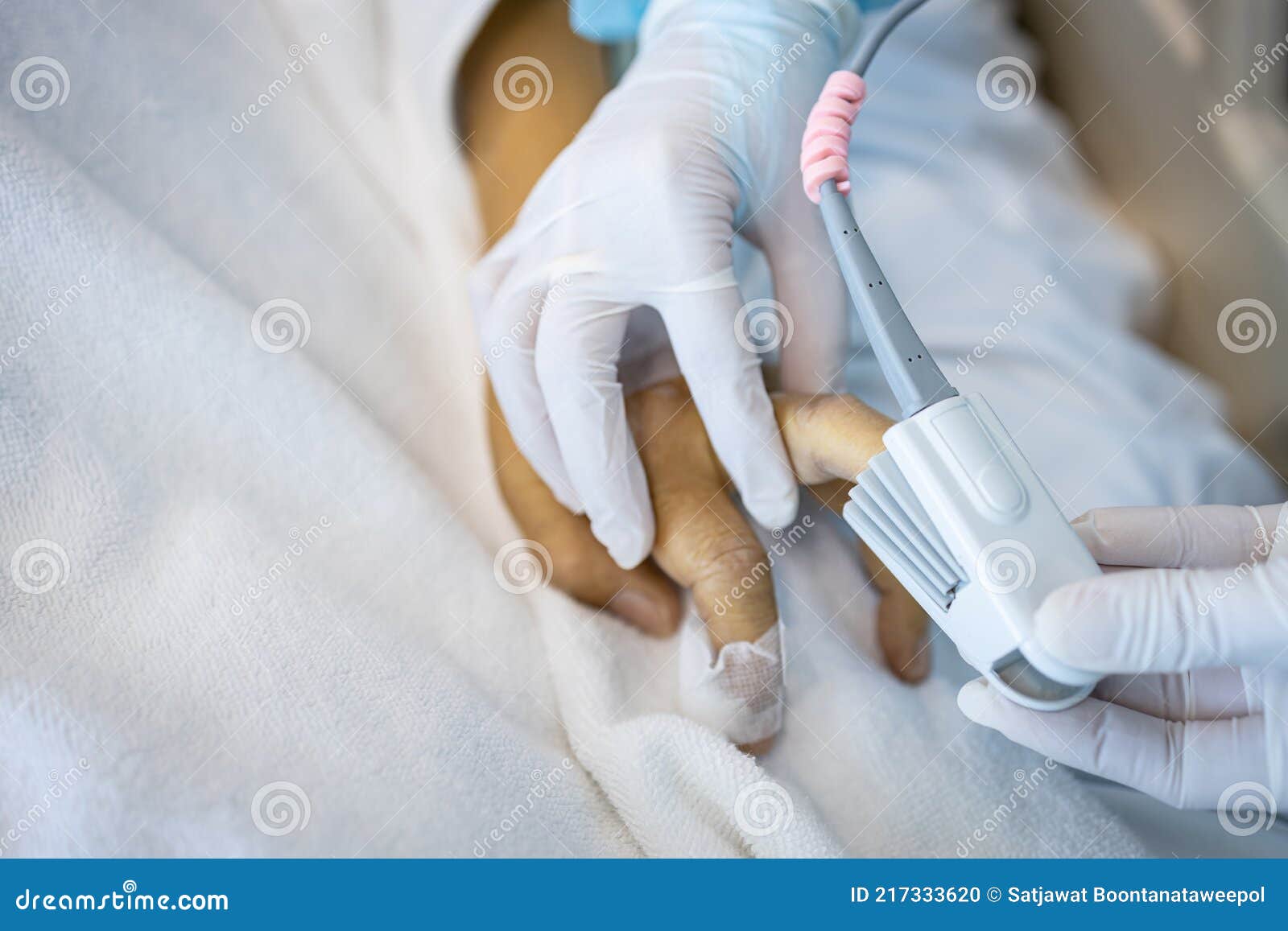 hand of an asian patient in a severe coma with an attached pulse oximeter on fingertip,nurse measuring heart rate,checking oxygen