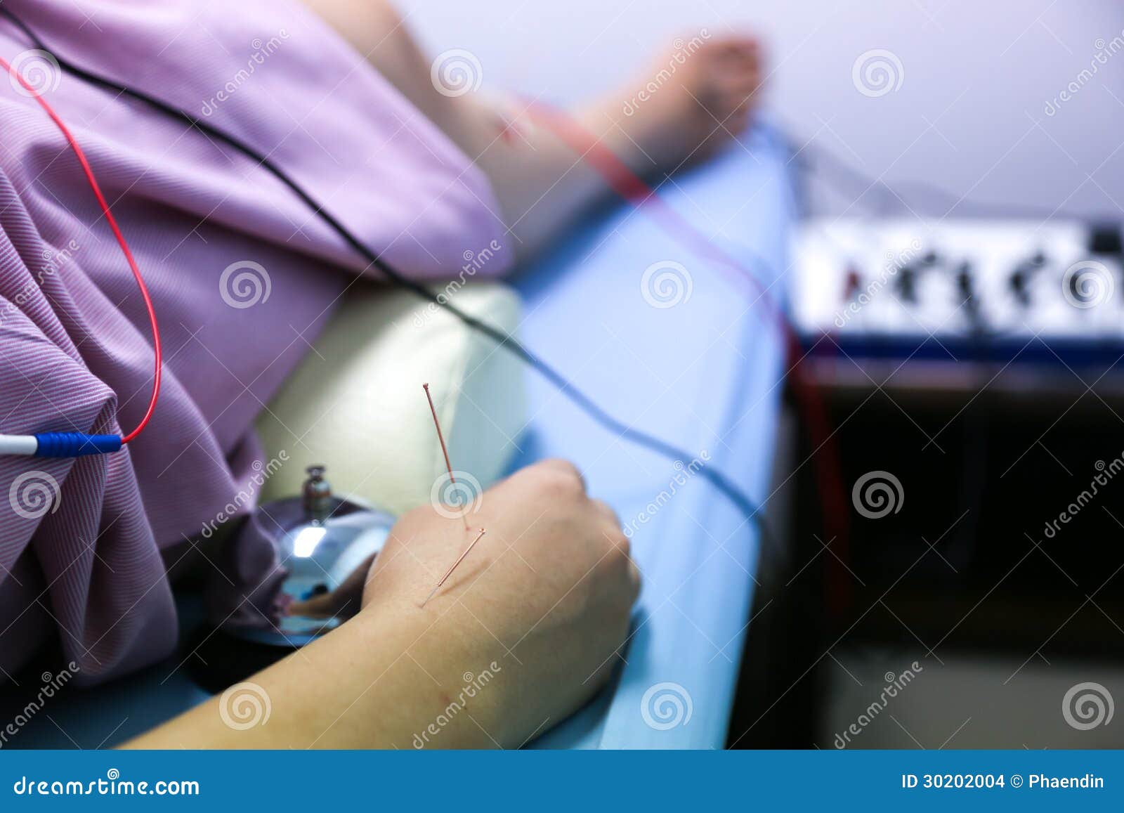 Hand of a Woman with Electrical Stimulating Acupuncture Treatment Stock