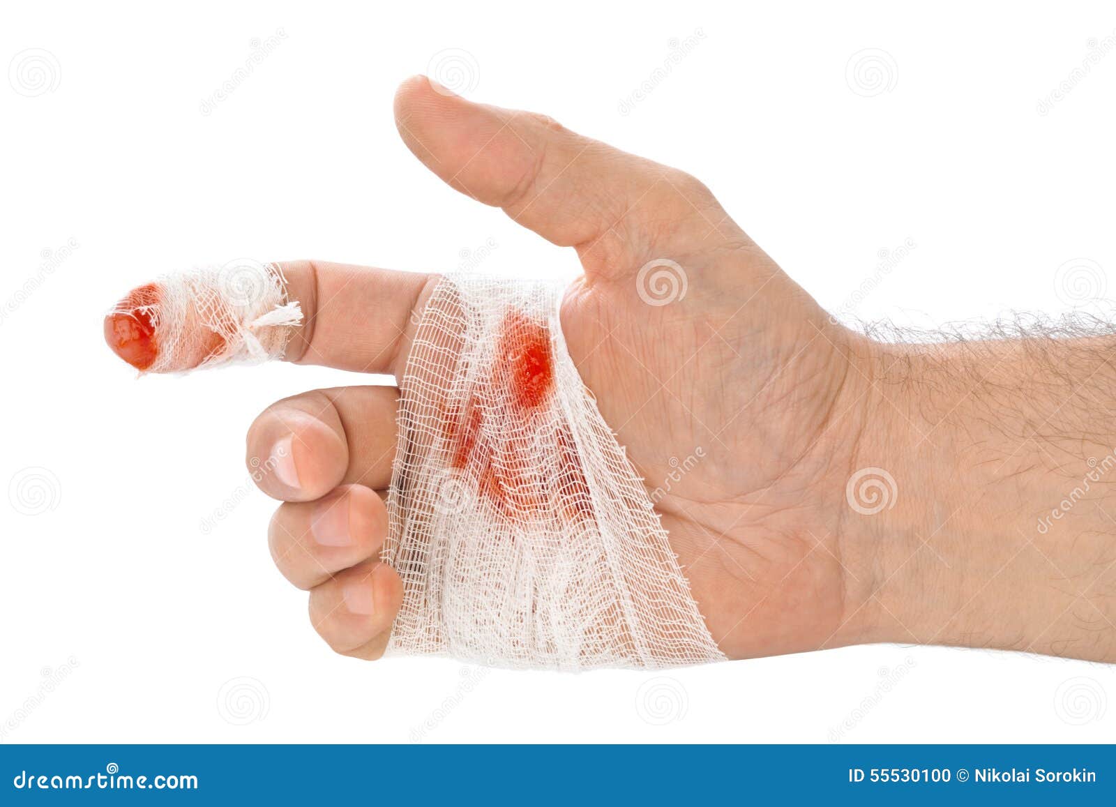 1 531 Hand Blood Bandage Photos Free Royalty Free Stock Photos From Dreamstime