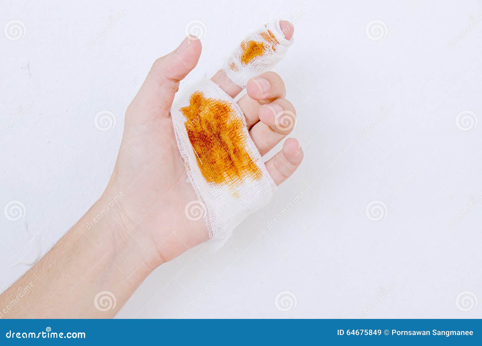 1 556 Hand Blood Bandage Photos Free Royalty Free Stock Photos From Dreamstime
