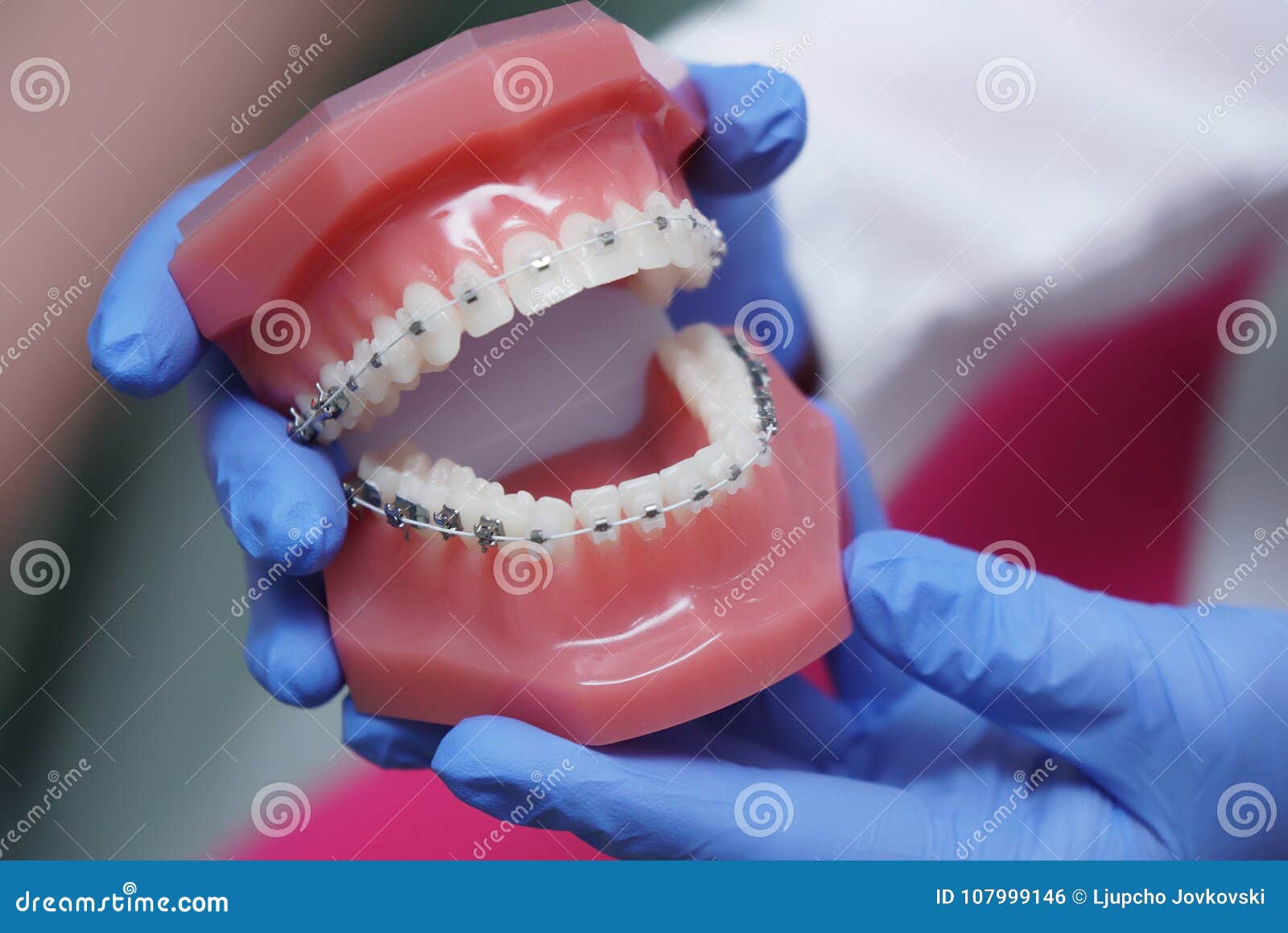 in hand on dentist orthodontics braces
