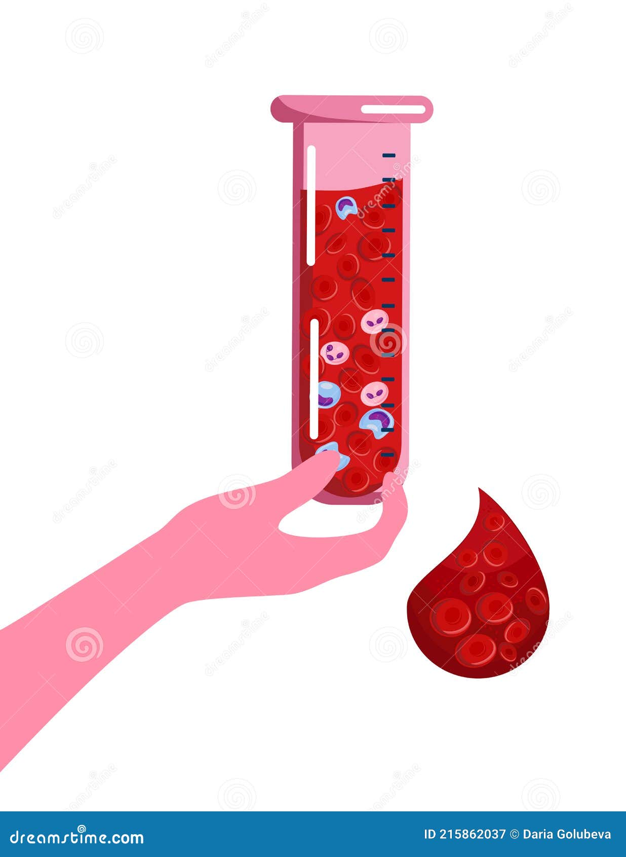 hand holds laboratory test tube or beaker with sick cells.world hemophilia day concept.