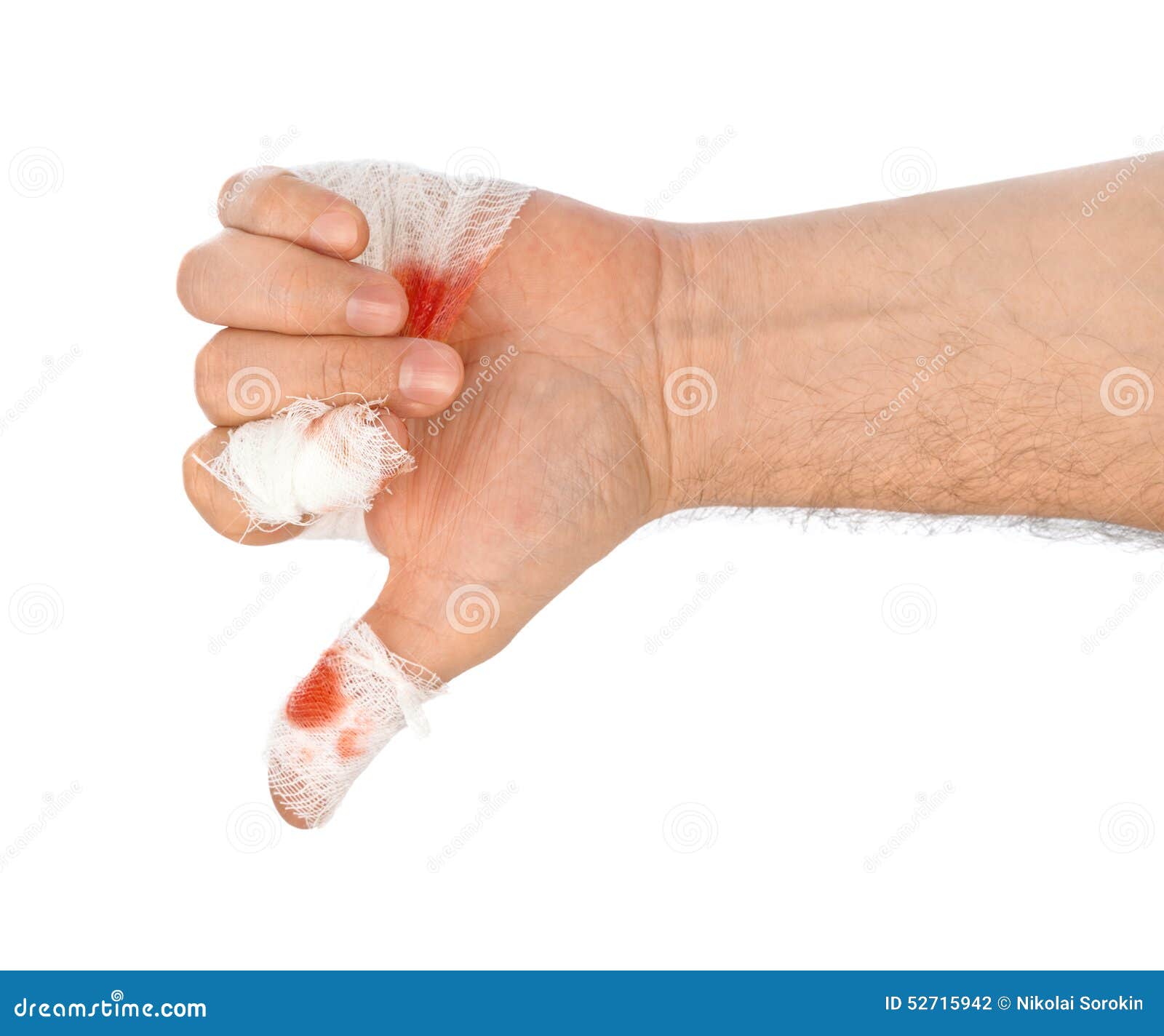Hand Thumb with Blood and Bandage Stock Photo Image of people, irritation 52715942