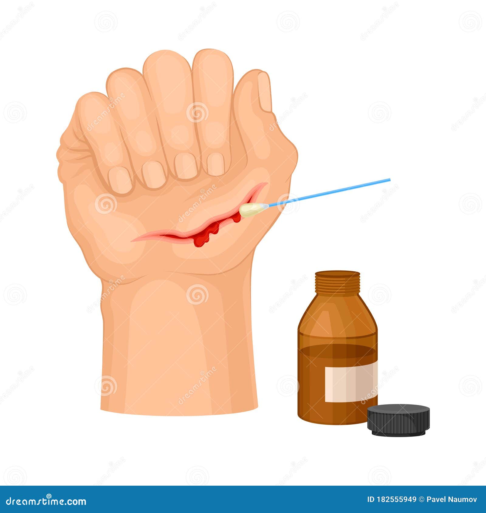 Hand with Wound Streaming Blood Cleaning with Pharmaceutical Substance ...
