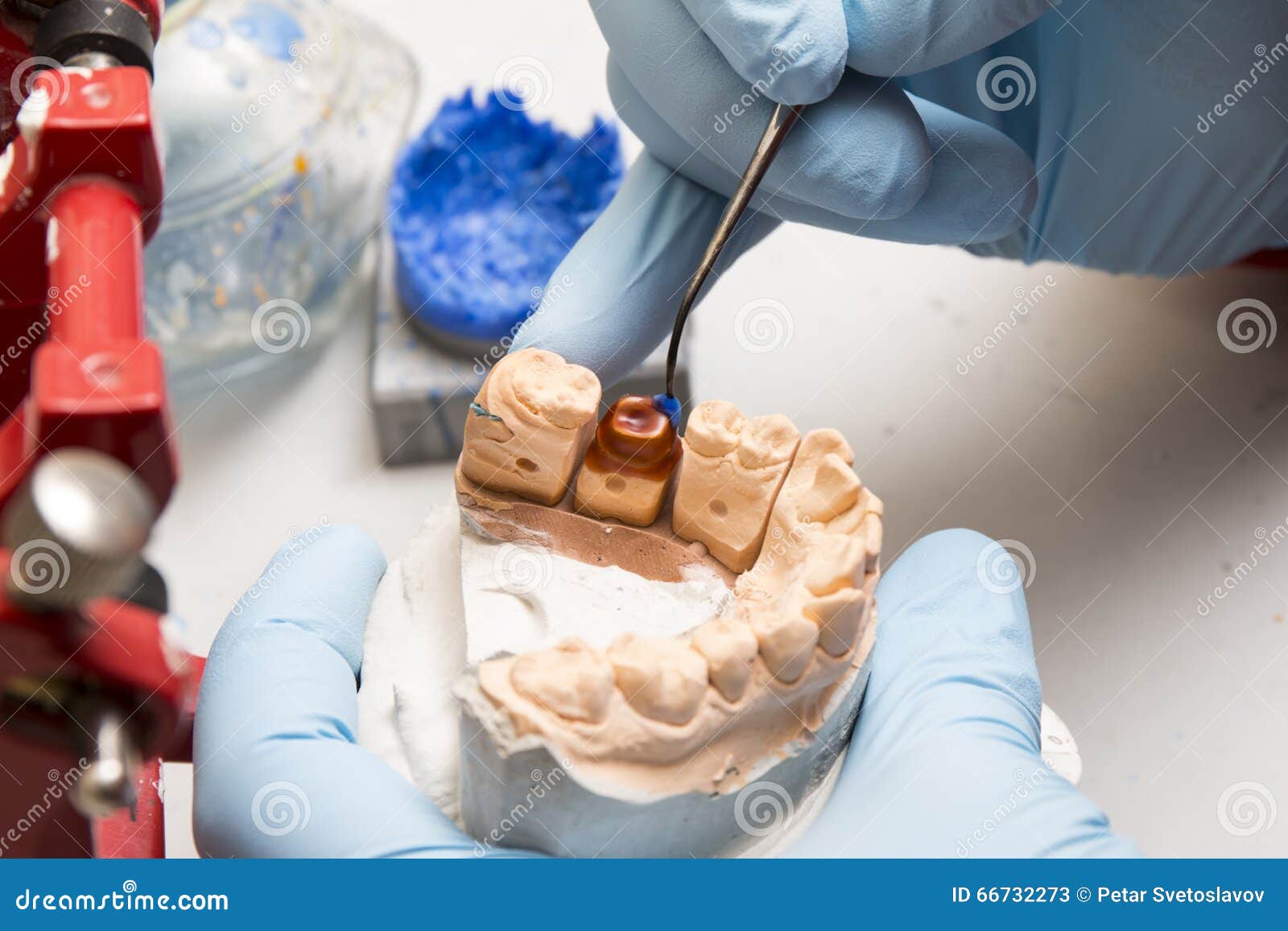 Hands of Dentist Working on a Dental Implant Stock Image Image of