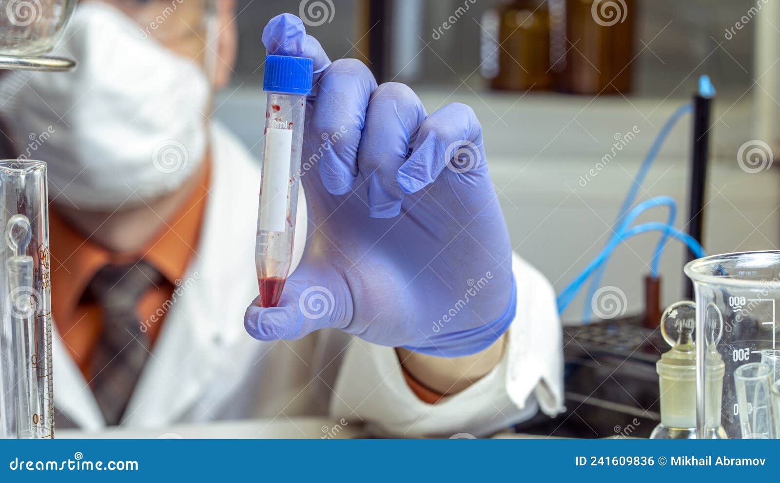 Hands of a Lab Technician with a Tube of Blood Sample and a Rack with