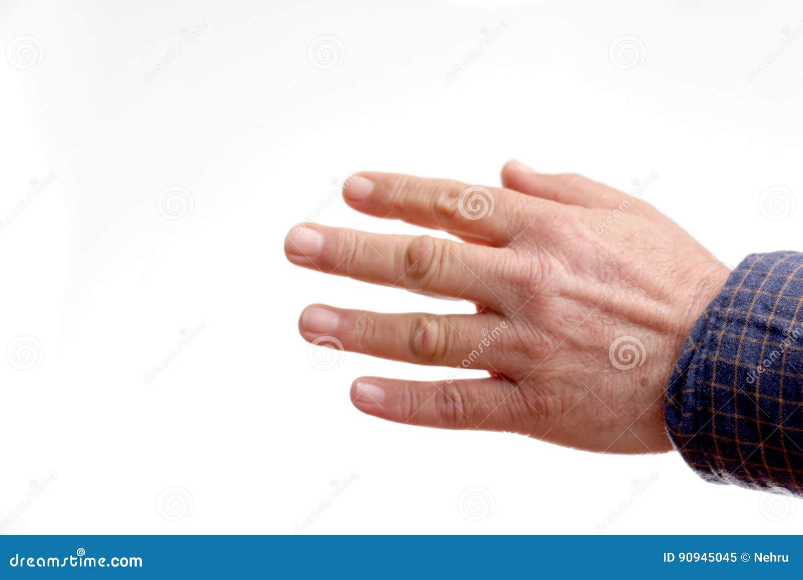 Hands of Middle-aged Woman Deformed by Arthritis Stock Image - Image of ...