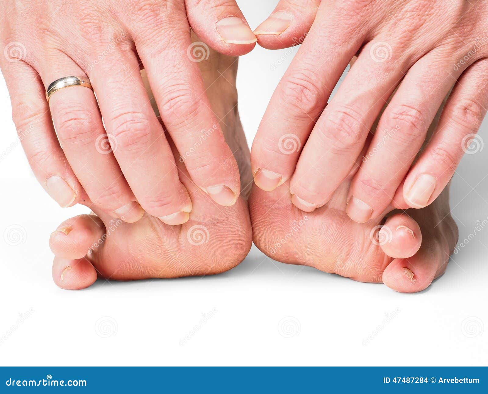 Hands Pulling Toes on Barefoot Feet Stock Photo Image of background