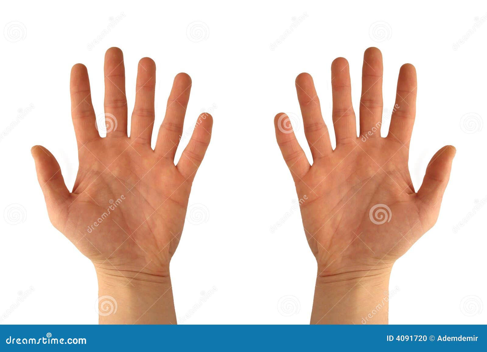 hands with six fingers