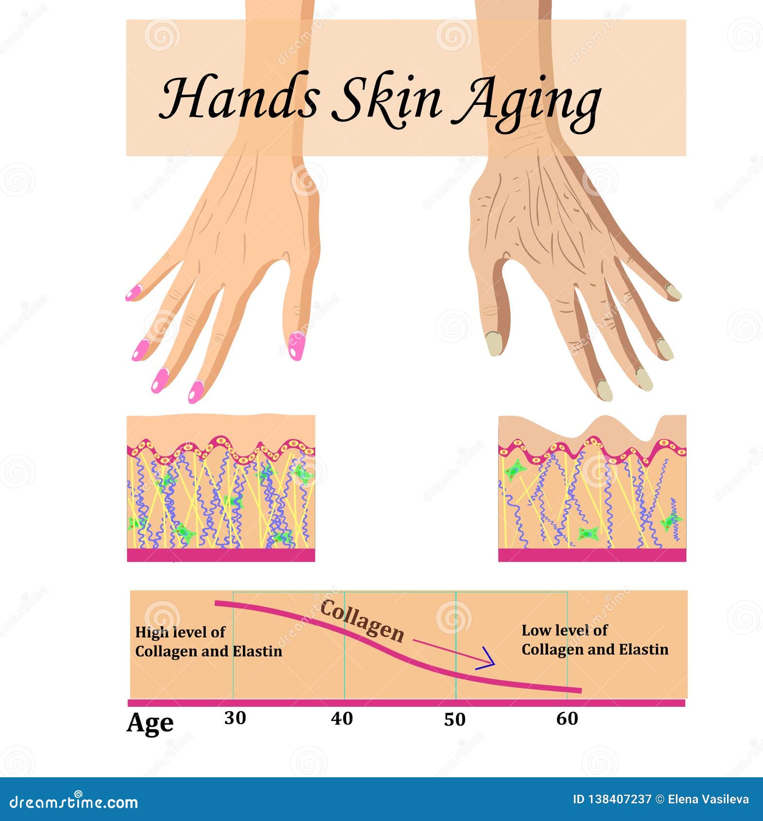 Skin Chart