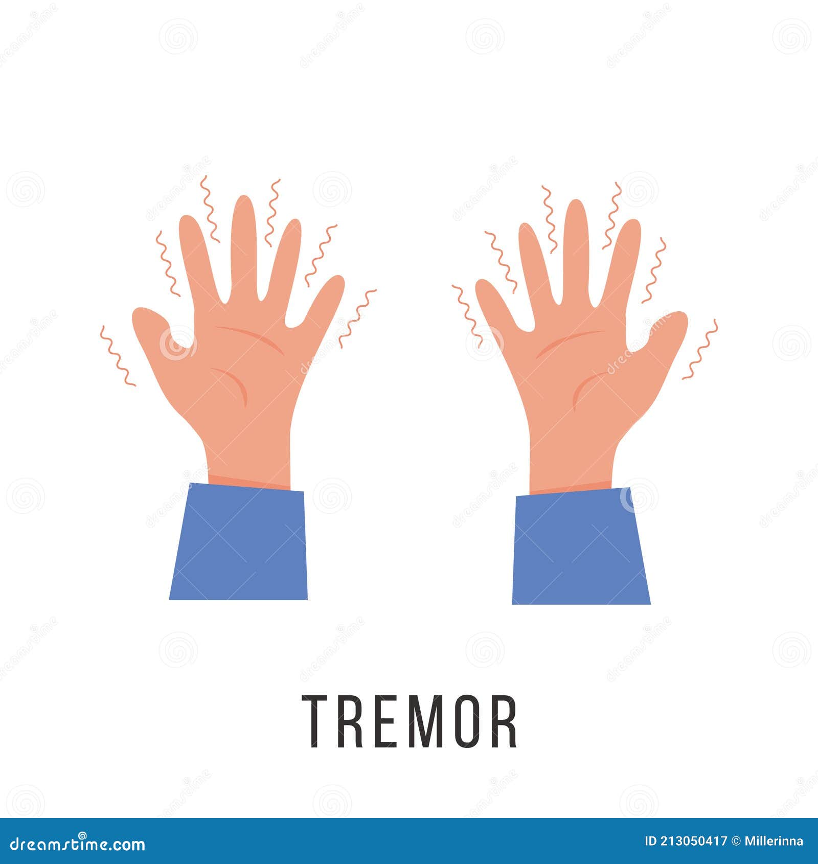 Hands with Tremor Symptom. Parkinson Disease. Trembling or Shivering ...