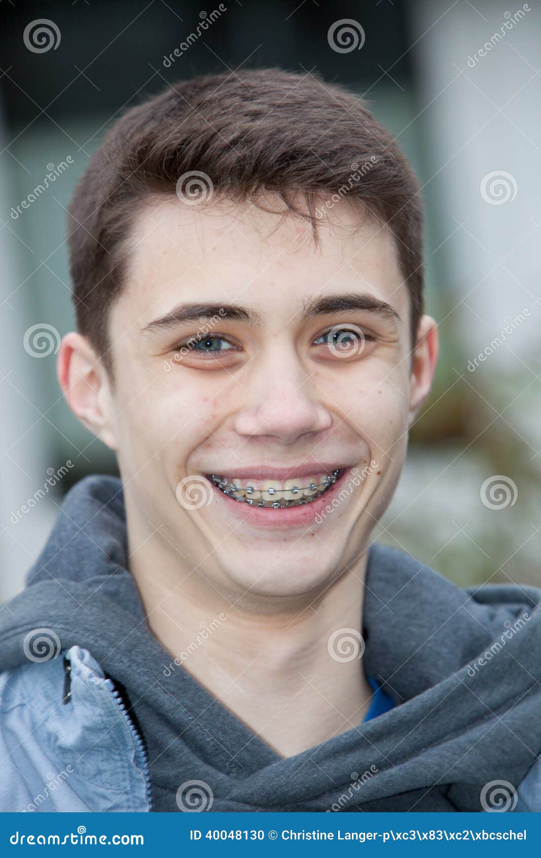 Young Teen With Braces Telegraph 