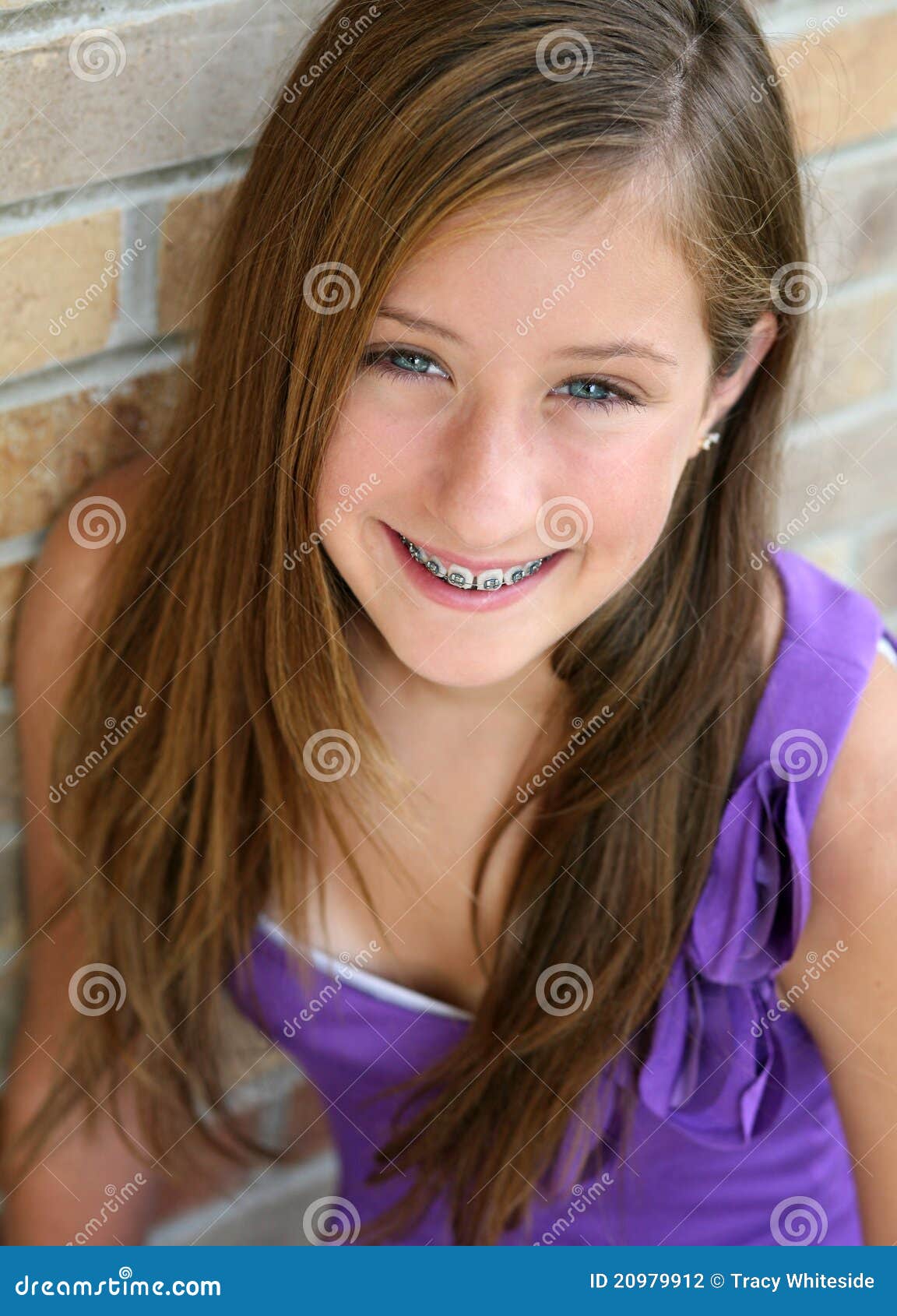 Teen Girls With Braces