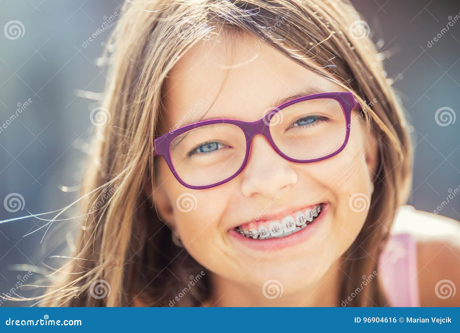 Happy Smiling Girl With Dental Braces And Glasses Young Cute Caucasian