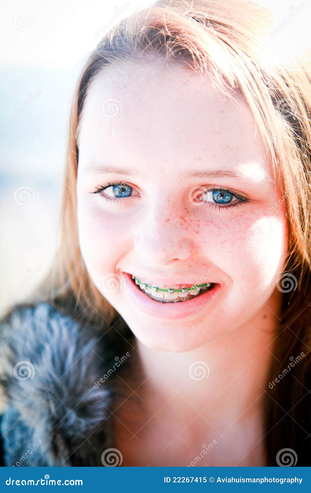 Happy Teen With Braces Outdoors Stock Image Im