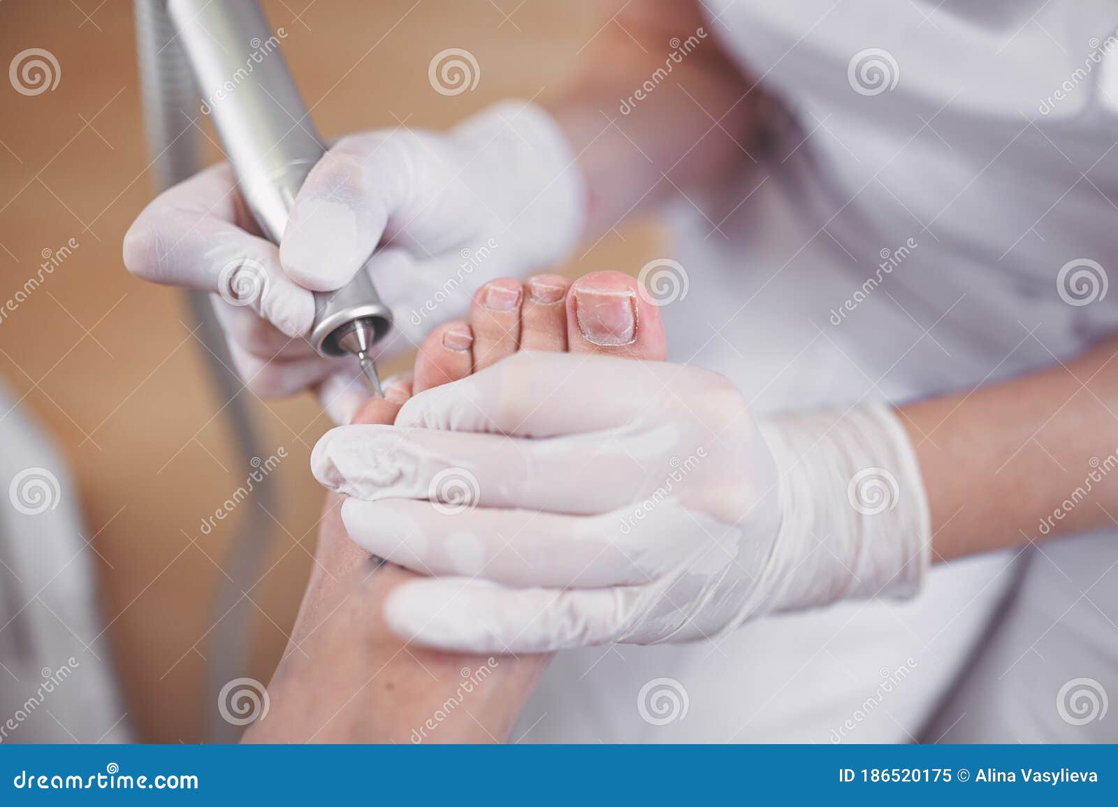 hardware medical pedicure with nail file drill apparatus. patient on pedicure treatment with pediatrician chiropodist. foot