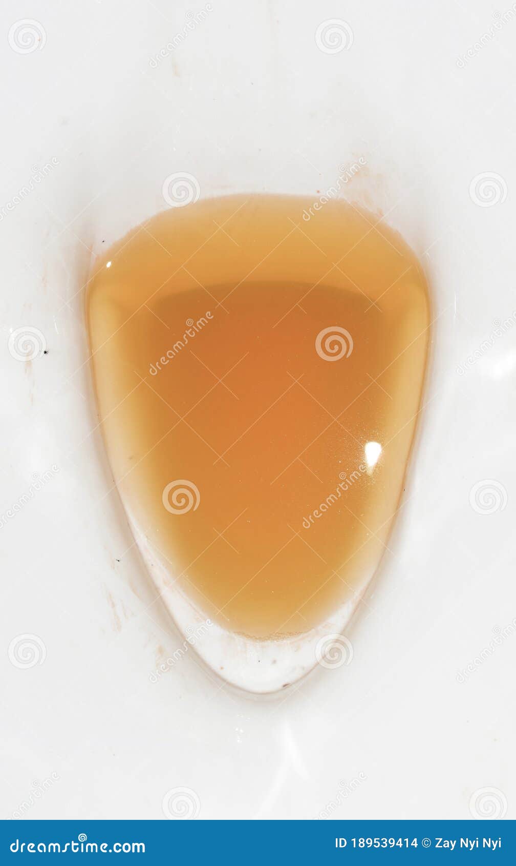Haute Urine Colorée Dans Les Toilettes Photo stock - Image du ...