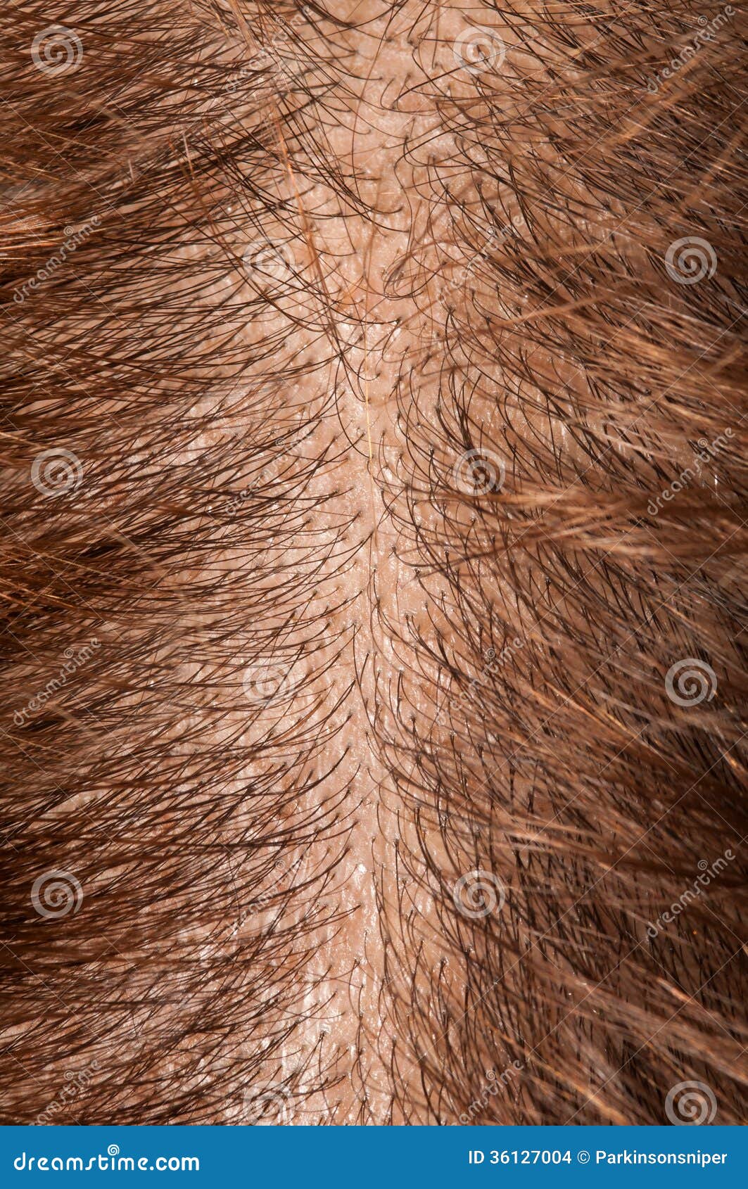 cunt pics hairy Young