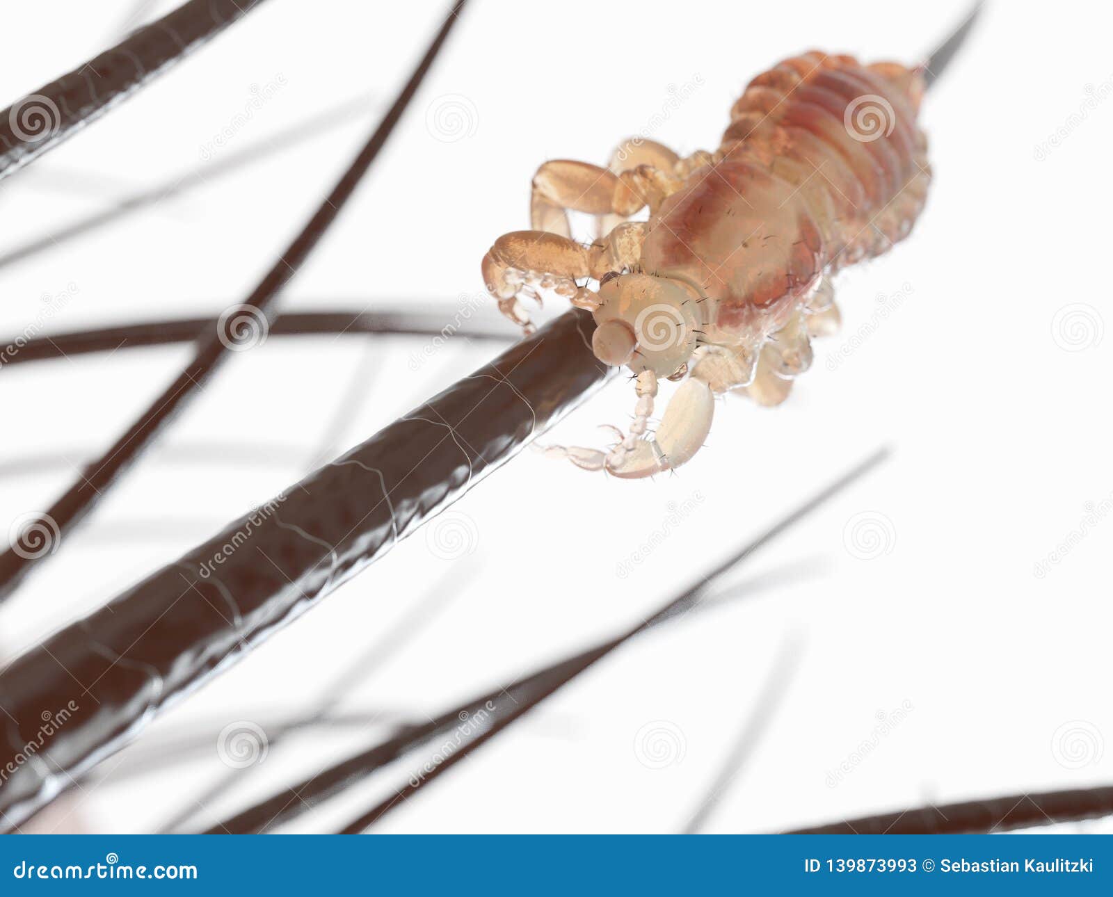 A head louse stock illustration. Illustration of artwork 139873993