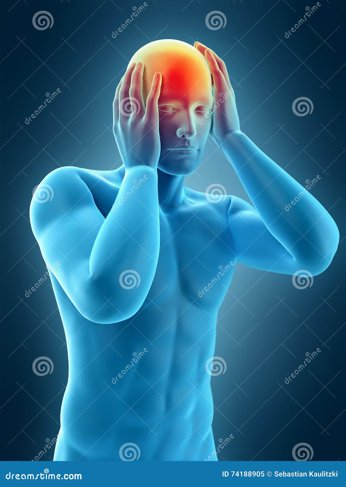 Headache/ migraine stock illustration. Illustration of cerebellum