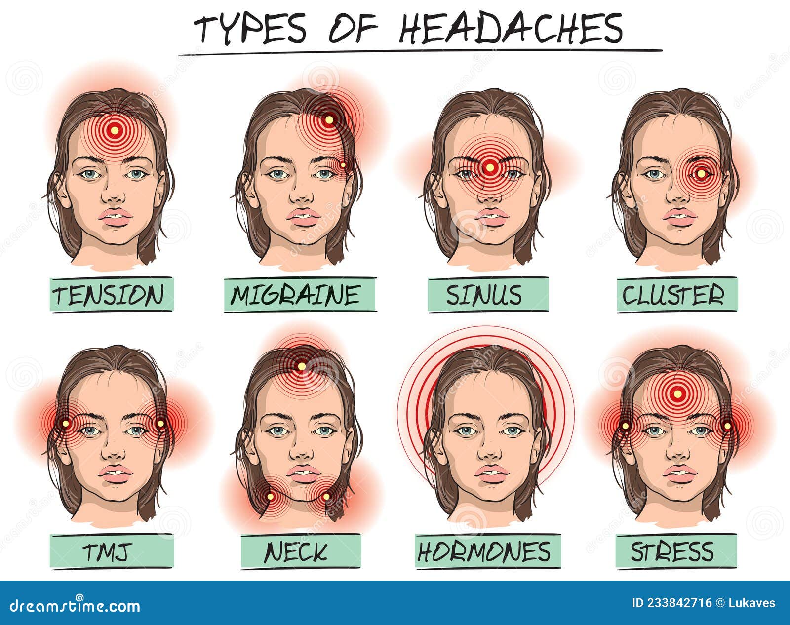 Headache Diagram