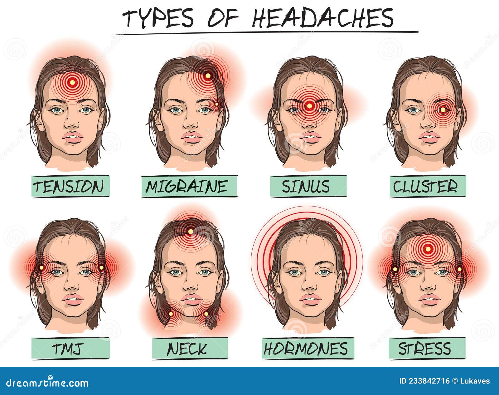 Types Of Headaches Set Of Headache Types Vector Illustration