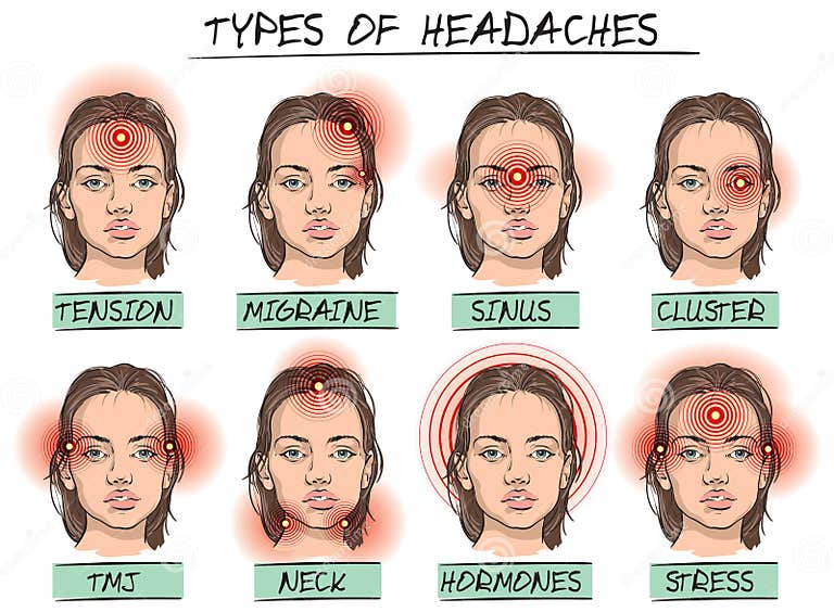 headache-types-stock-vector-illustration-of-resolution-233842716