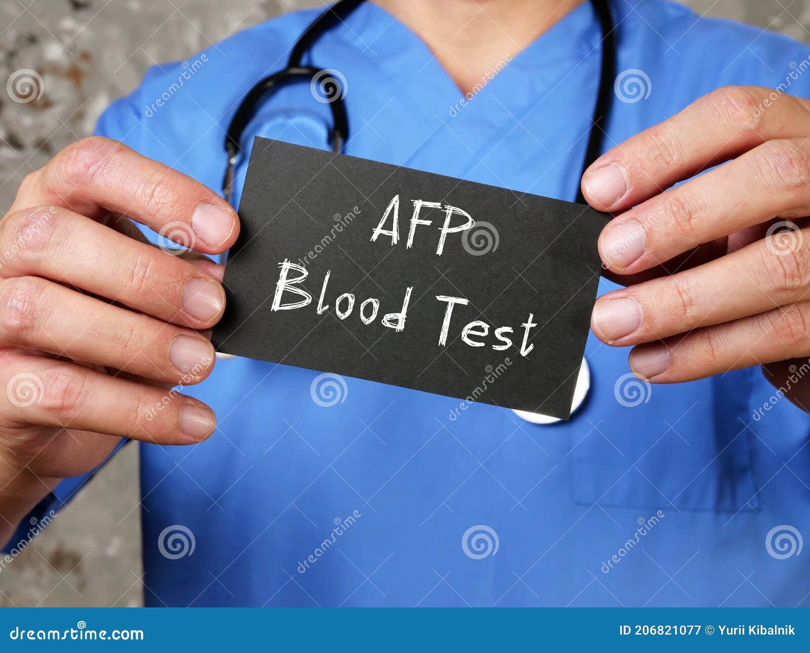 health care concept meaning alpha-fetoprotein blood test afp blood test with inscription on the page