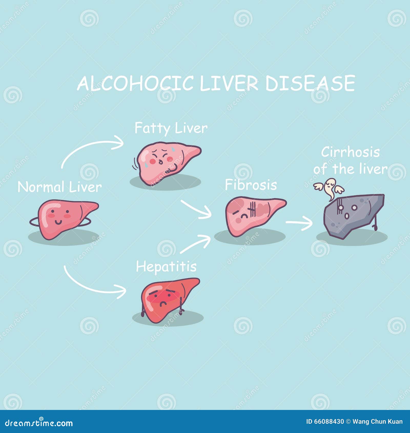 health liver vs cirrhosis liver