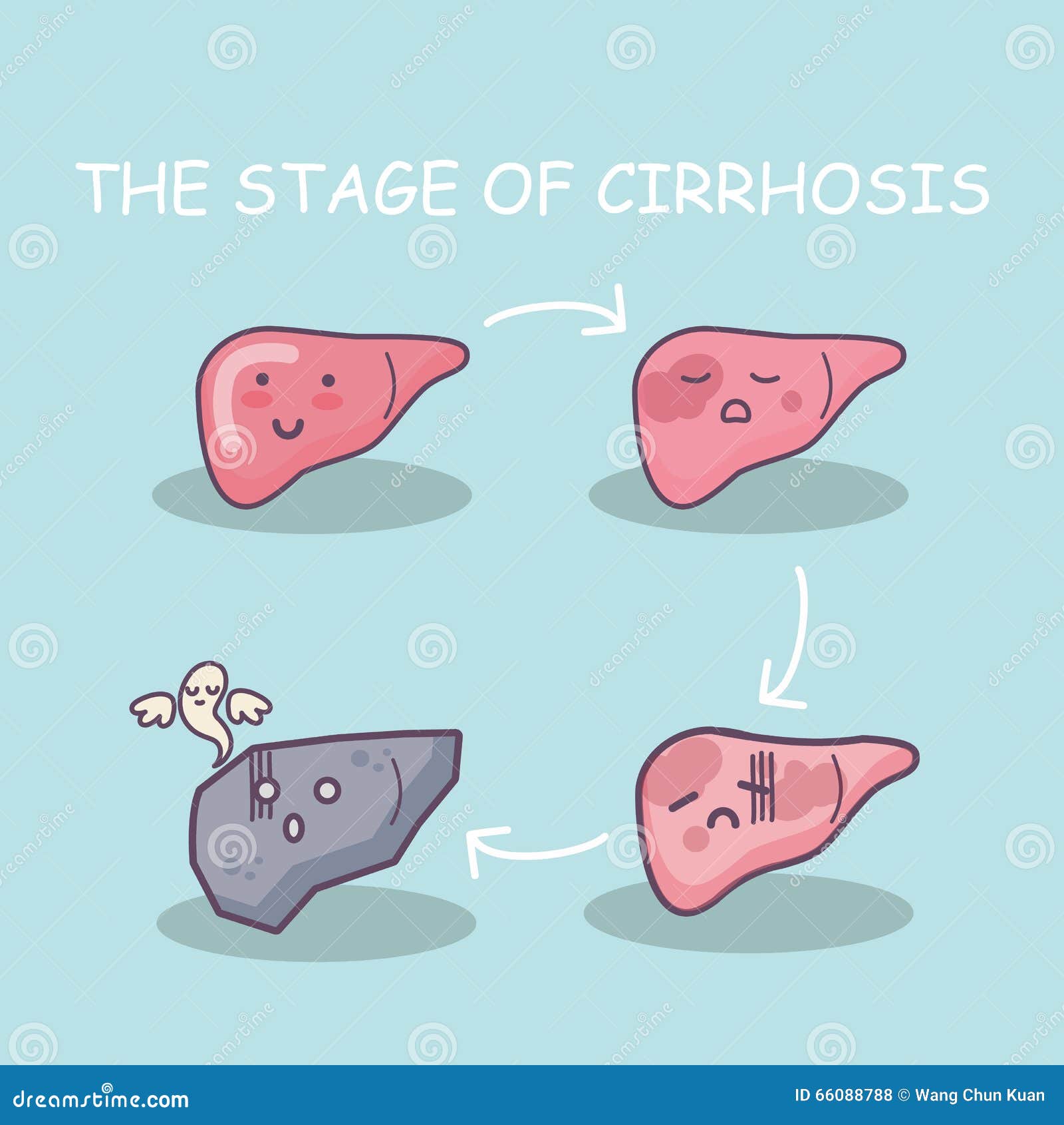 health liver vs cirrhosis liver