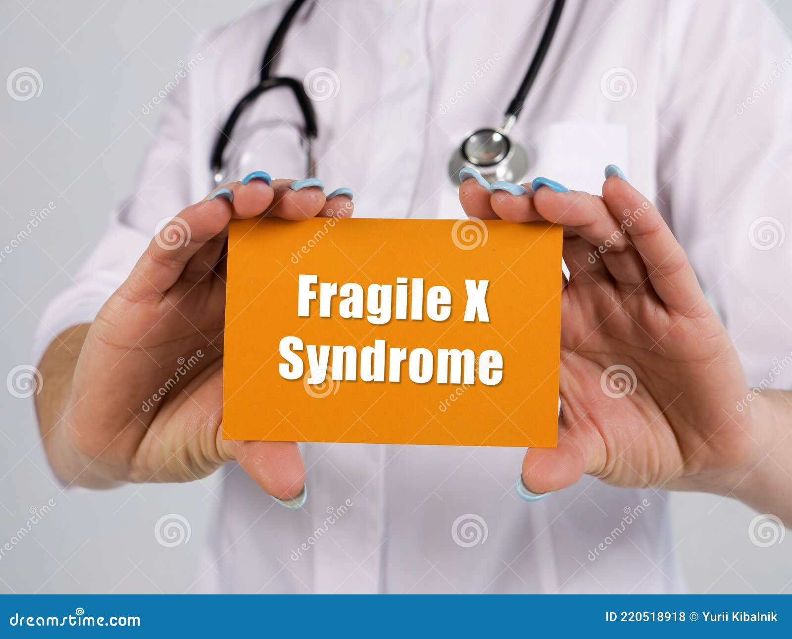 healthcare concept meaning fragile x syndrome with inscription on the piece of paper
