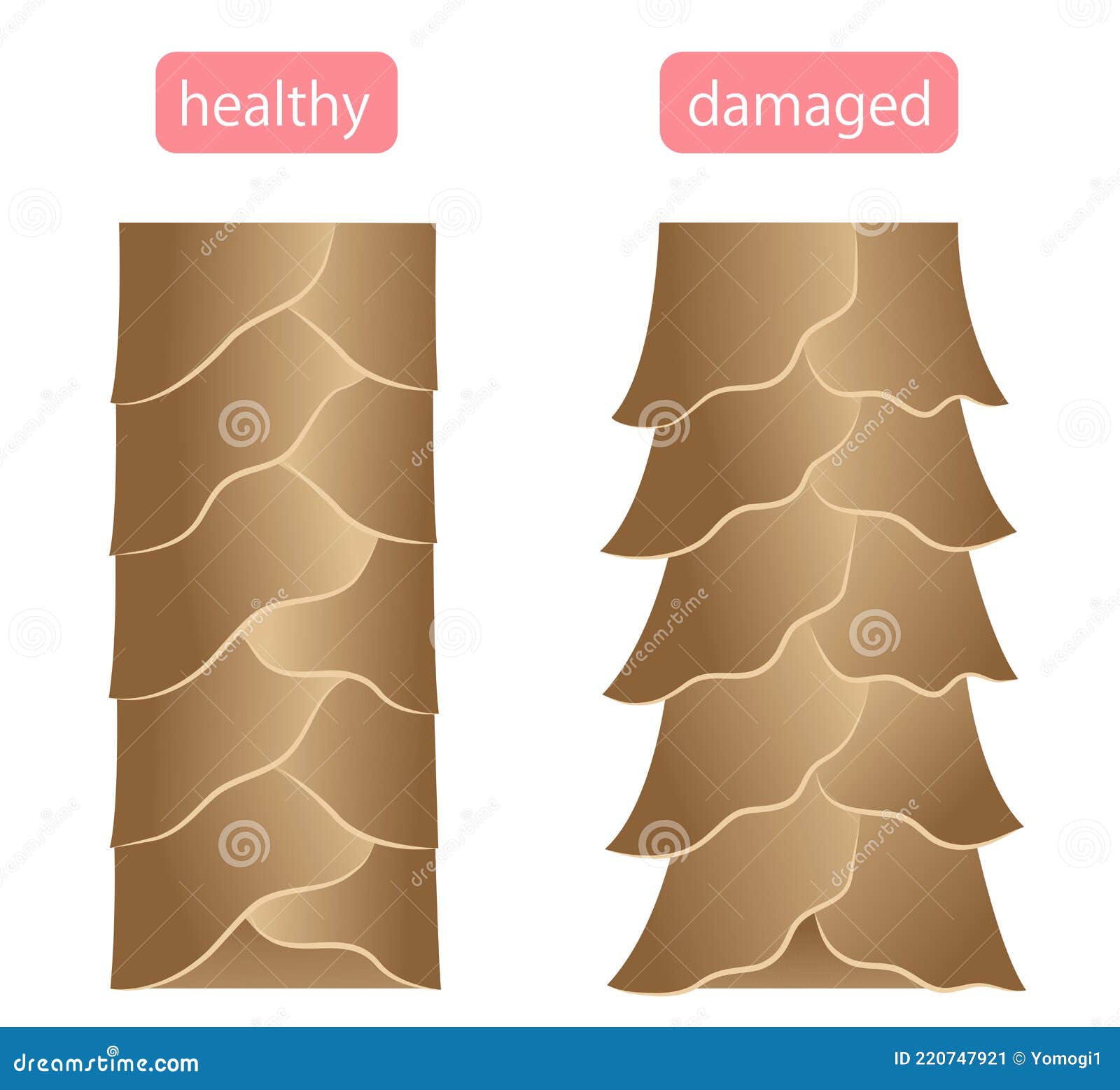 Healthy and Damaged Hair Cuticle Illustration. Hair Care and Beauty Concept  Stock Vector - Illustration of smooth, body: 220747921