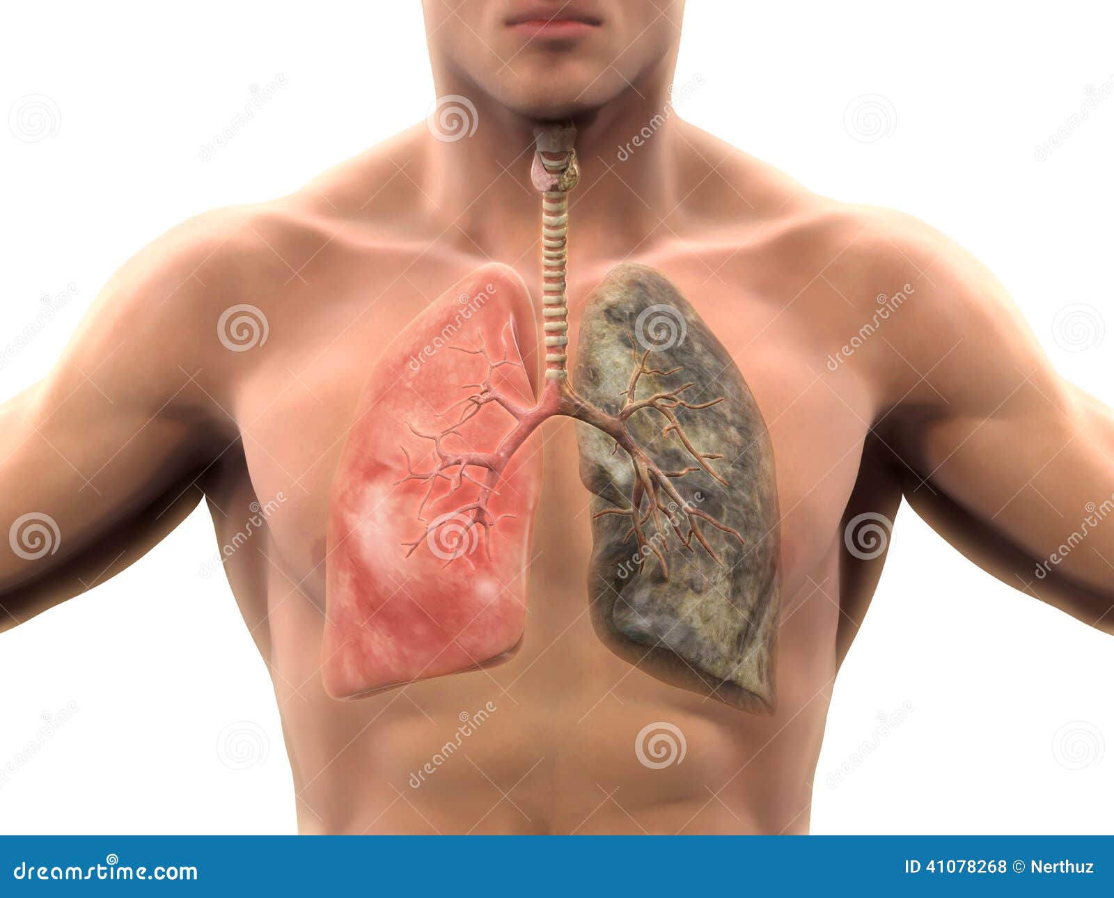 Non Smoker Lungs Vs Smoker