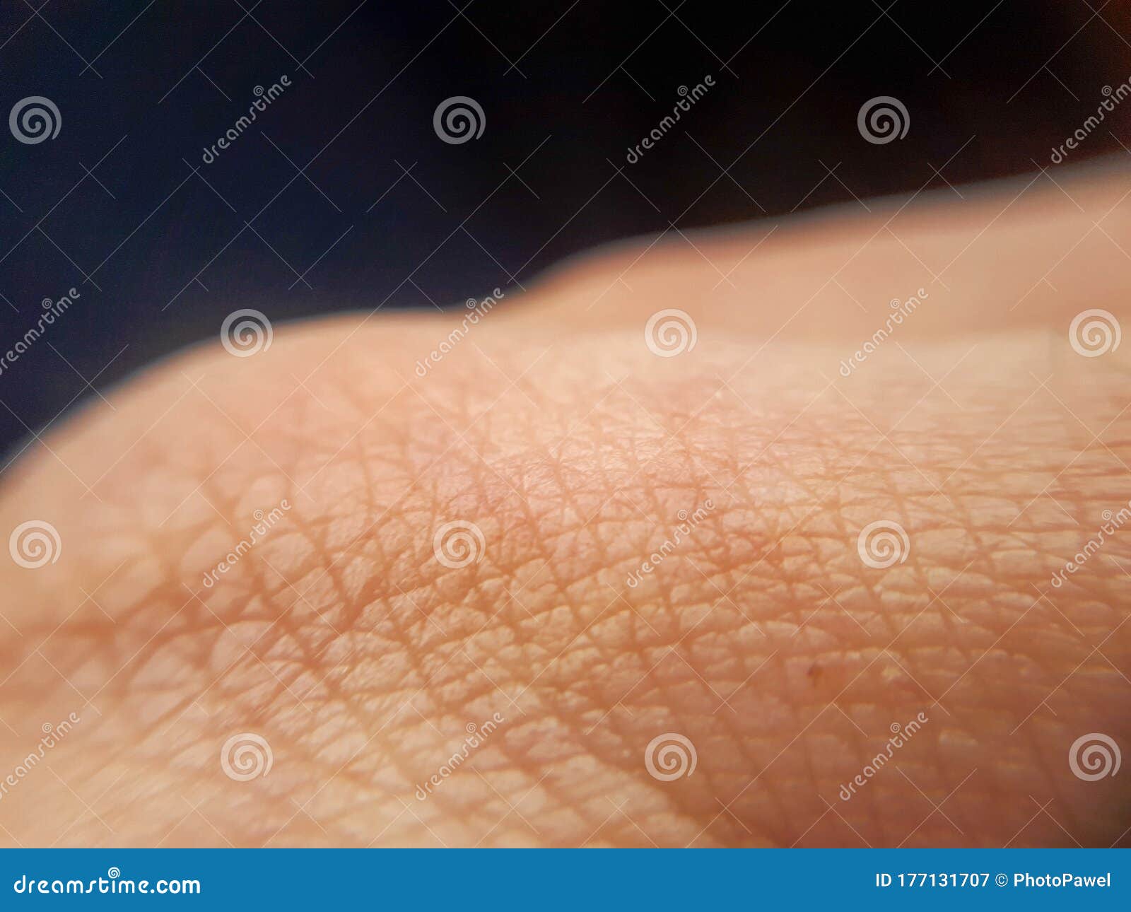Healthy Orange Skin Background. Macro Hand Skin Stock Image Image of