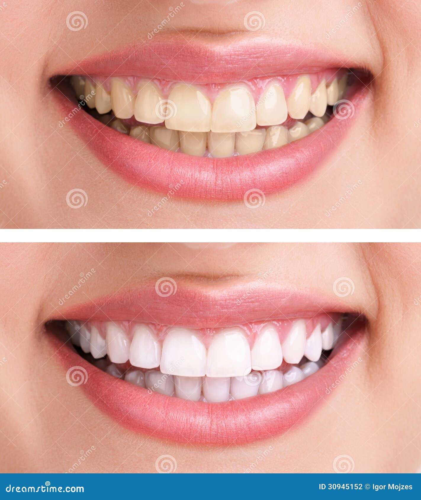 healthy teeth and smile