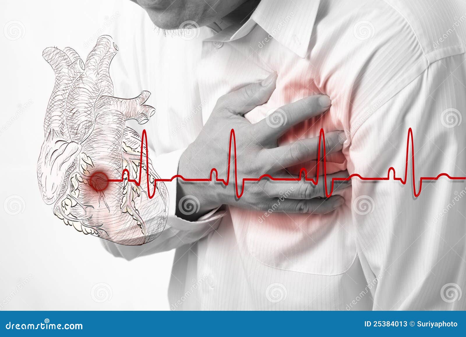 heart attack and heart beats cardiogram