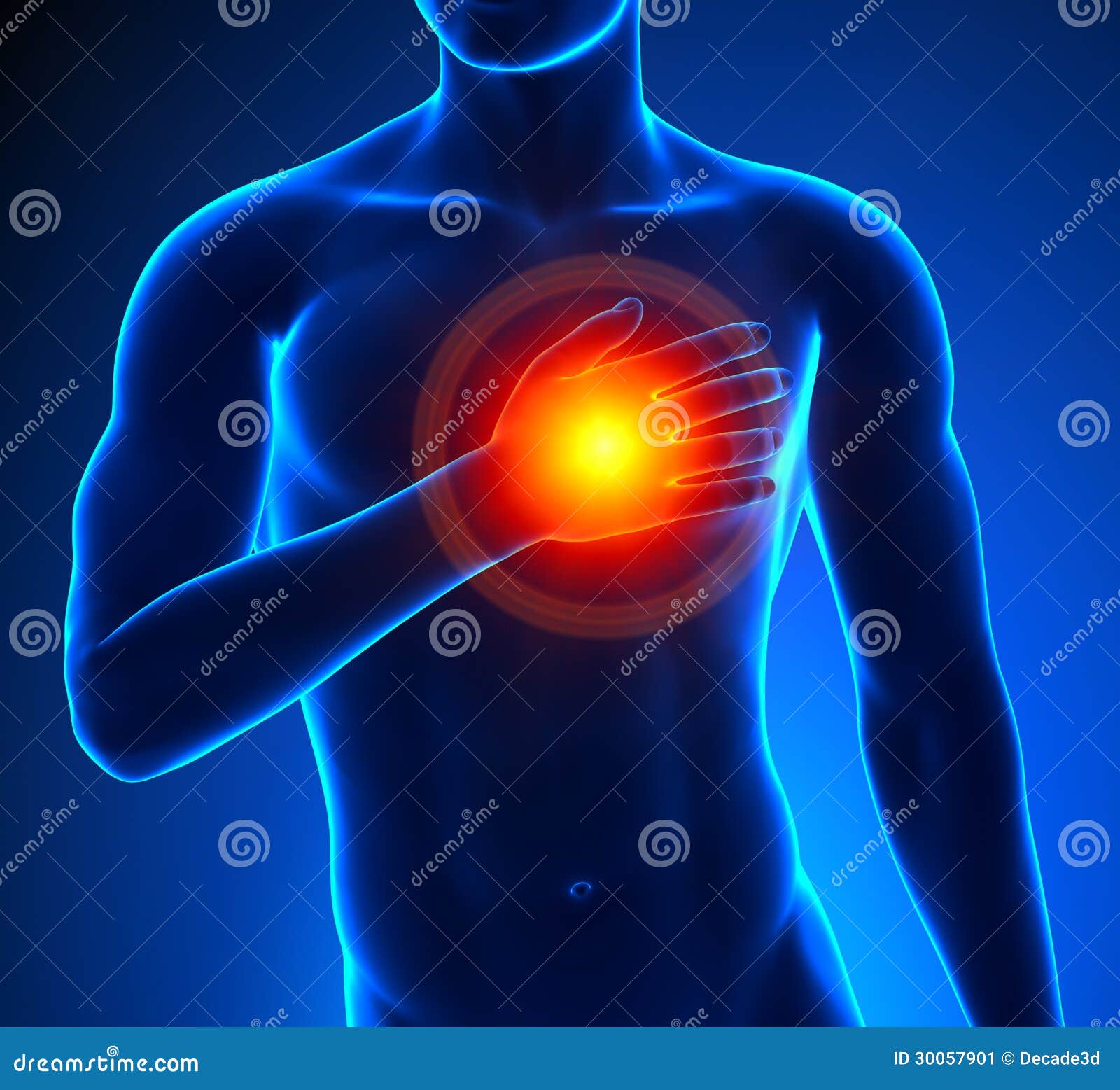 HeartAttack Male stock illustration. Illustration of mature 30057901
