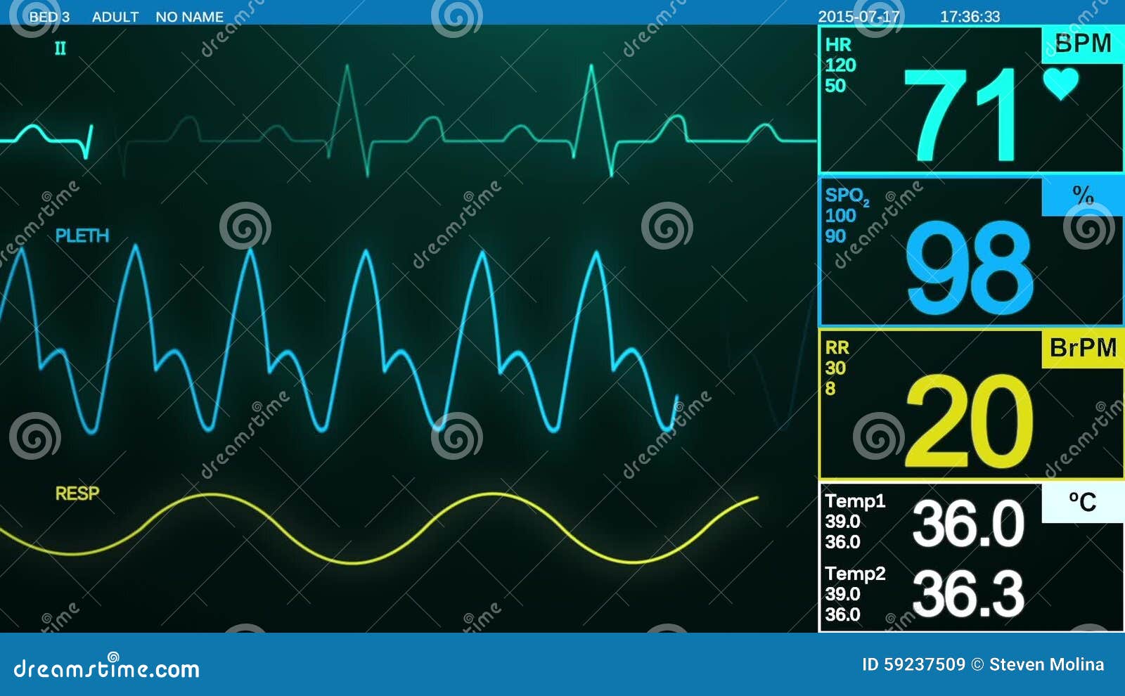 Heart beat monitor stock video. Video of cardiac, heartbeat - 59237509