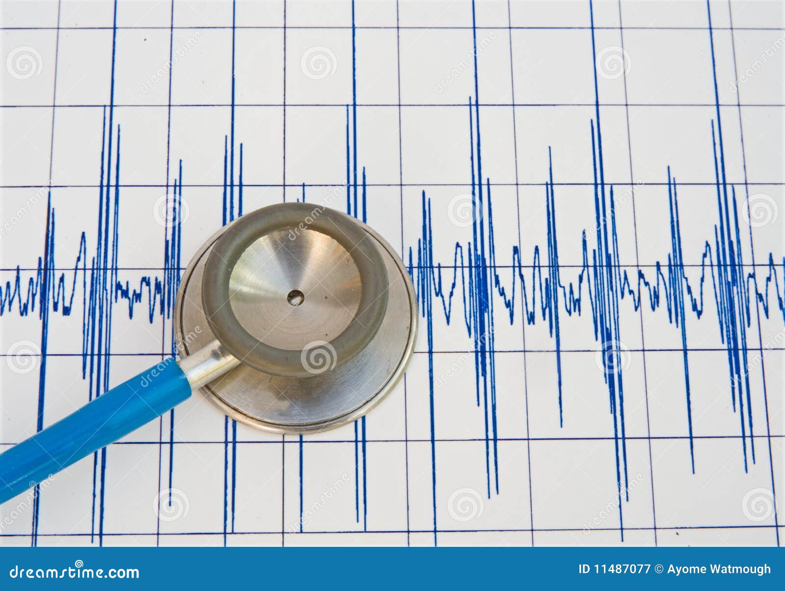Heart beat recording. stock illustration. Illustration of rate 11487077
