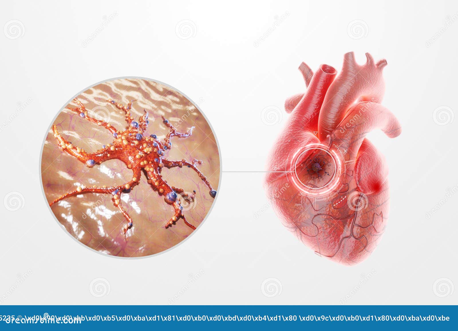 heart cancer, tumor, human anatomy, disease. concept of health care, medicine, biology. 3d render, 3d , copy space,