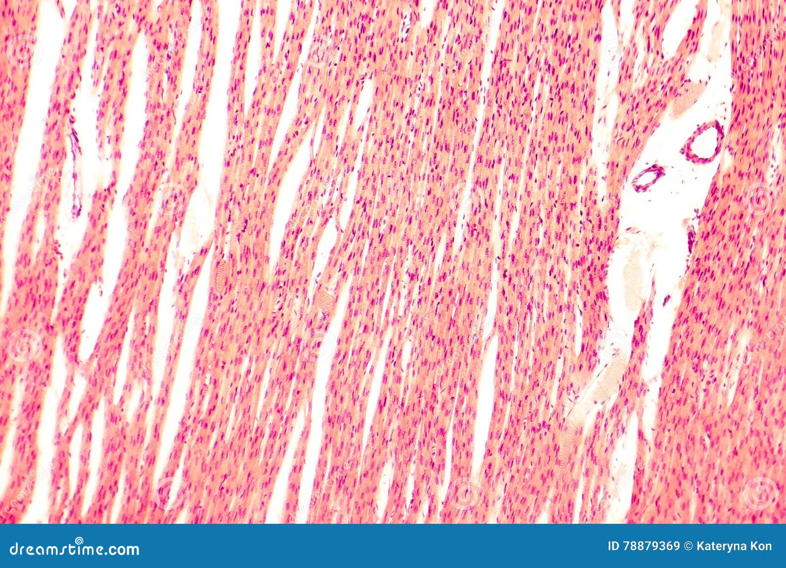 heart muscle, light micrograph