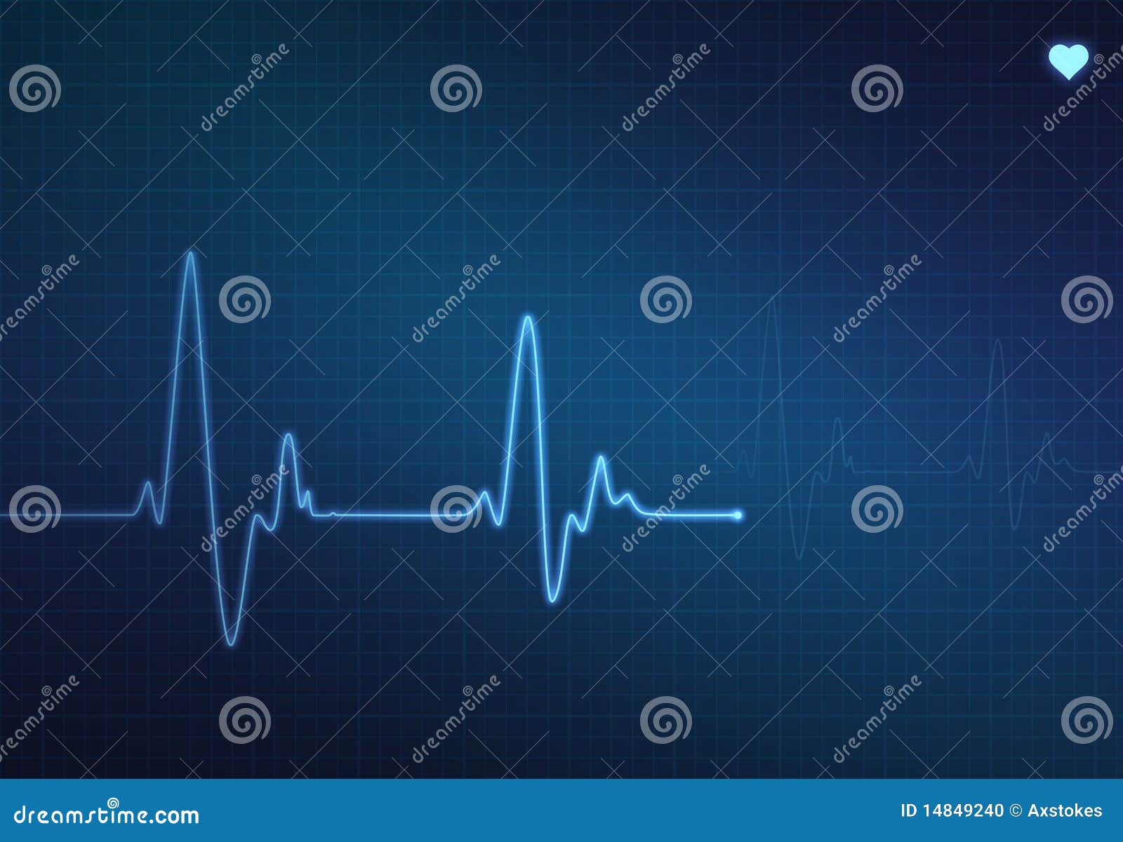 heartbeat monitor