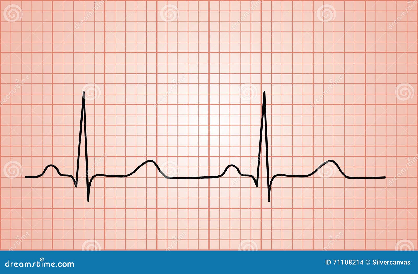 Electrocardiograma Foto