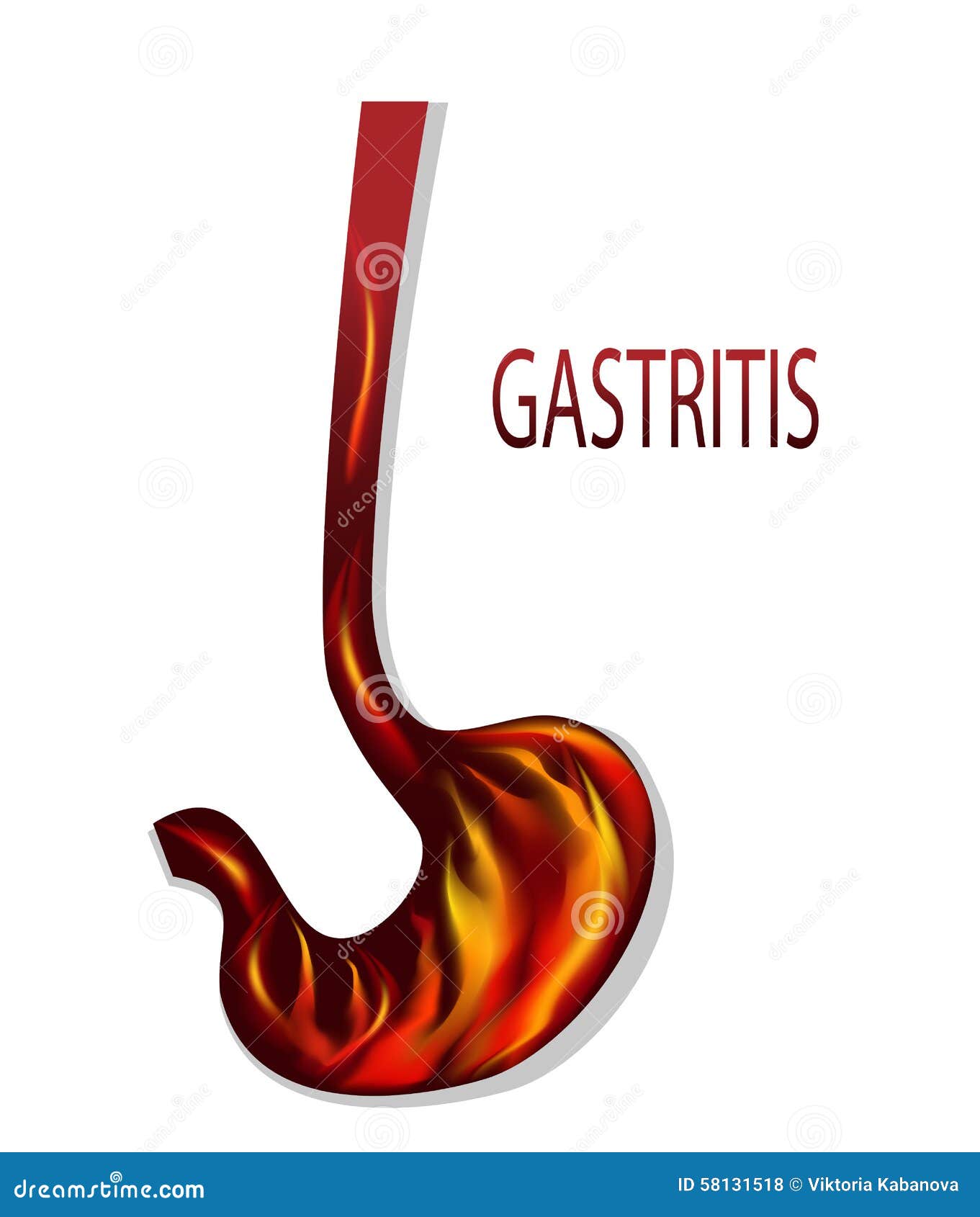 heartburn, gastritis