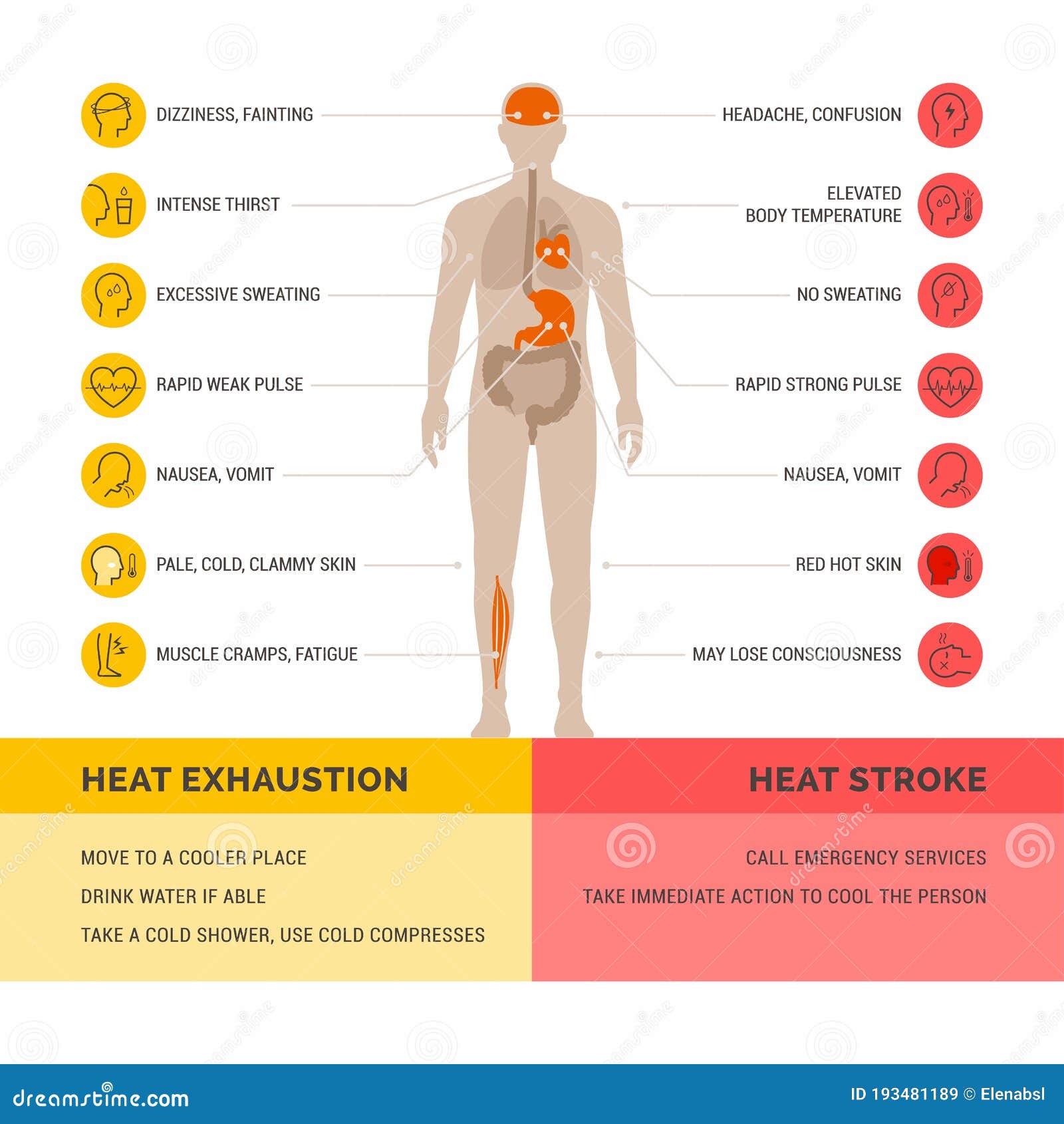 heat exhaustion and heast stroke infographic