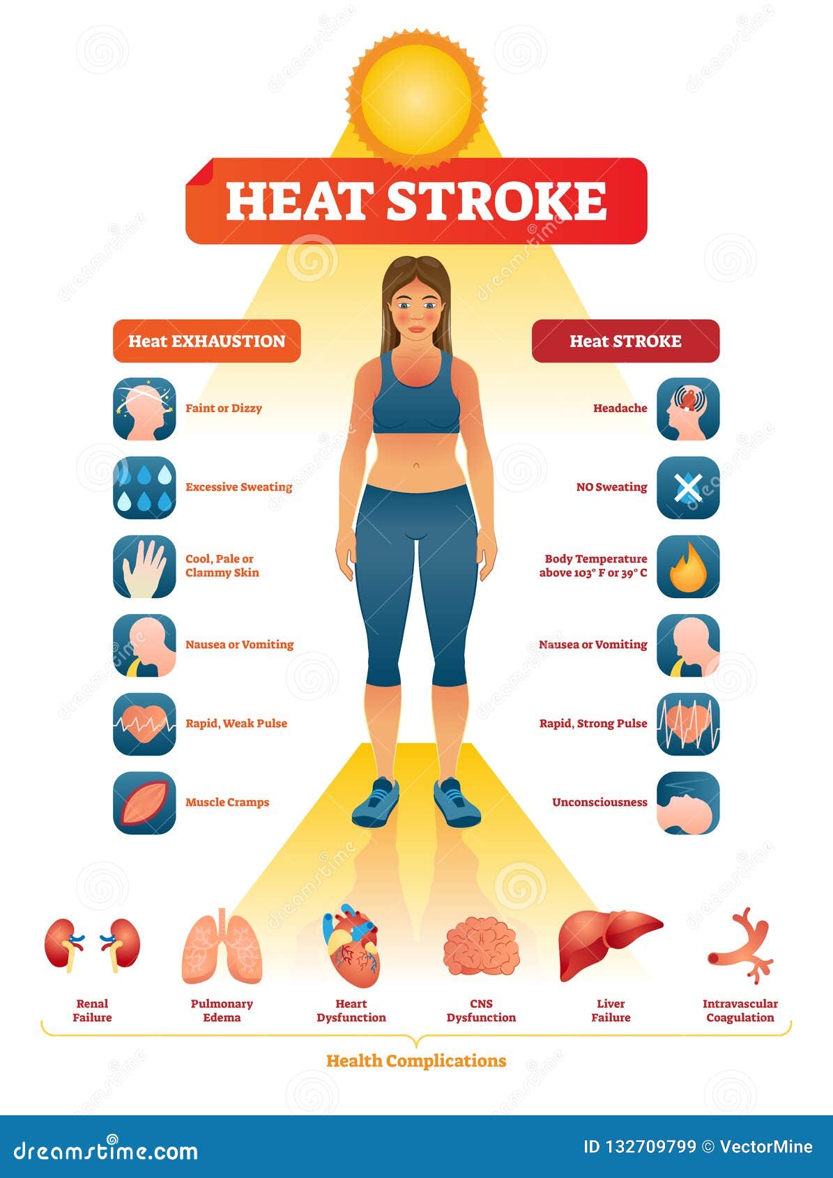 heat stroke  . exhaustion symptoms labeled medical list.