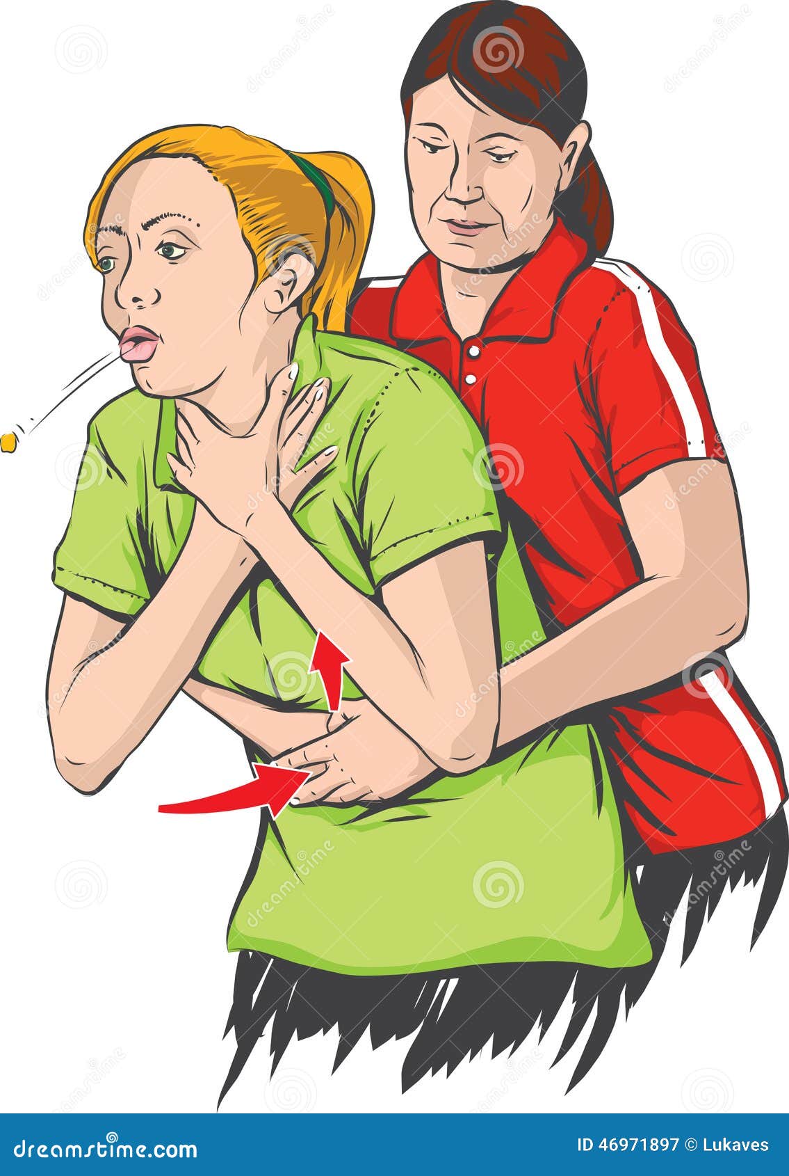 heimlich maneuver