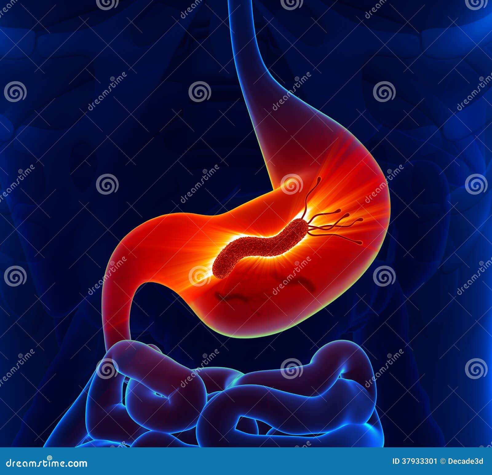 helicobacter pylori - stomach