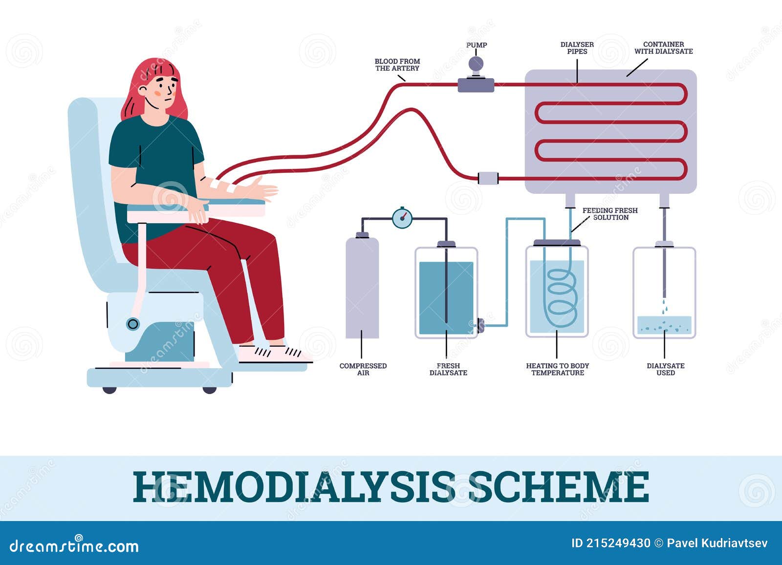 Hemodialysis Procedure Vector Illustration | CartoonDealer.com #18160348