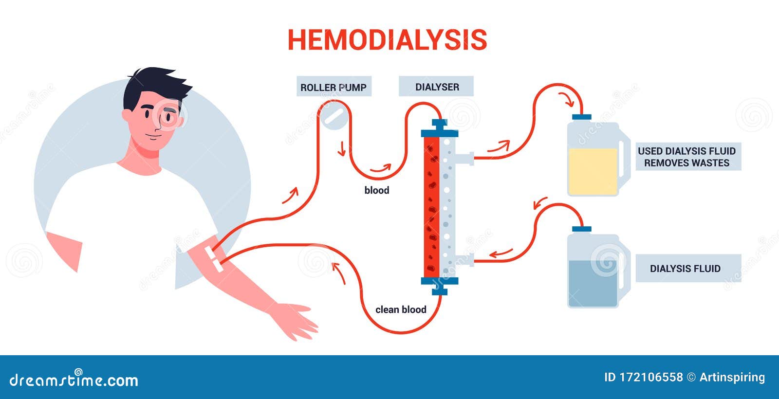 hemodialysis-for-kidney-treatment-man-get-a-kidney-disease-vector
